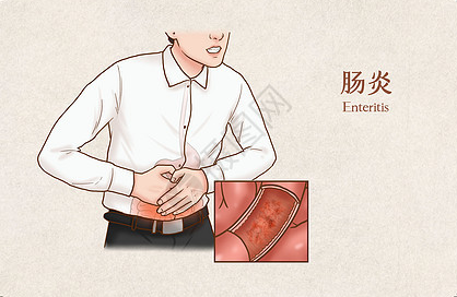 大理肛泰肛肠医院：是什么导致的慢性肠炎？