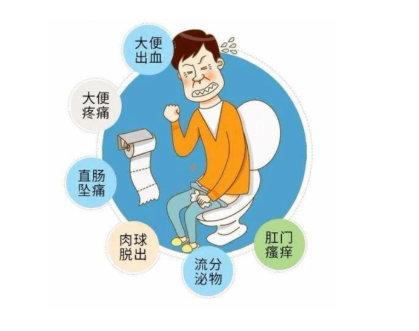 大理肛泰肛肠医院：混合痔—集两“痔”之长，不要小看它