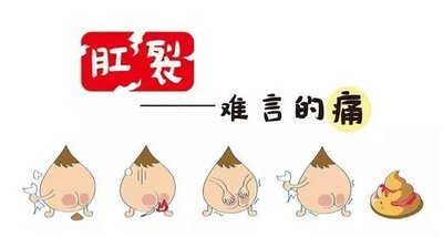 大理肛泰肛肠医院：慢性肛裂的诱因有哪些?