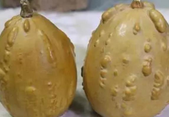 大理肛泰肛肠医院：肛窦炎是怎么回事?