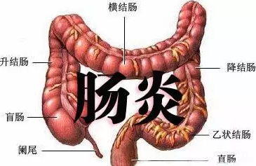 大理肛泰肛肠医院：直肠炎会带来哪些危害呢？