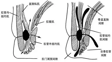 大理肛泰肛肠医院：肛窦炎的四大常见症状