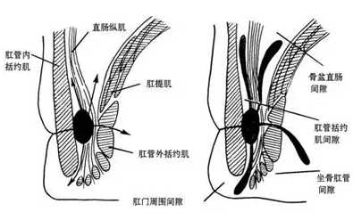 大理肛泰肛肠医院：肛窦炎常见的四大症状