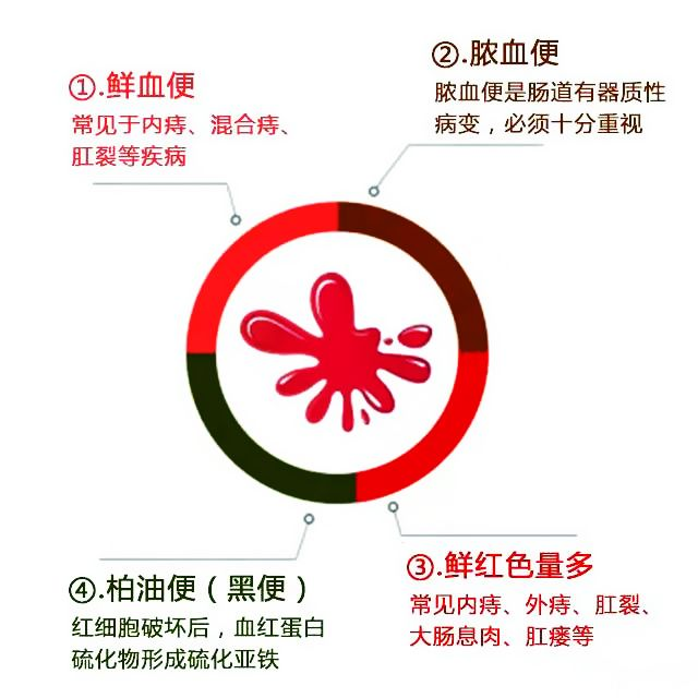 大理肛泰肛肠医院：上厕所大便出血？警惕肛肠疾病在作怪！