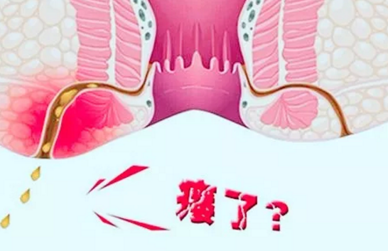 大理肛泰肛肠医院：肛瘘是怎么回事？肛瘘危害大吗？