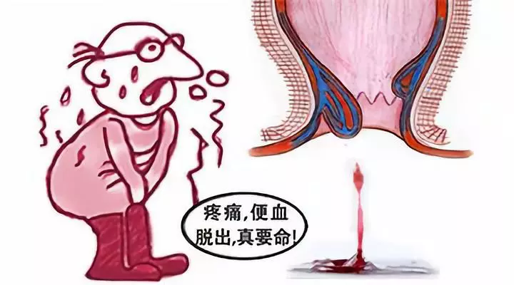 大理肛泰肛肠医院：肛裂，究竟用药还是手术？哪个效果好呢？