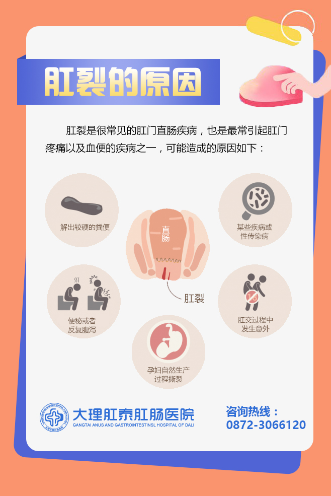 理肛泰肛肠医院：肛裂一定要手术？看完这篇文章你就知道了！