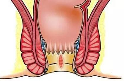 大理肛泰肛肠医院：女性产后如何防肛裂？日常防护是关键