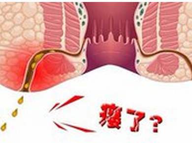 大理肛泰肛肠医院：肛瘘自愈的可能性大吗