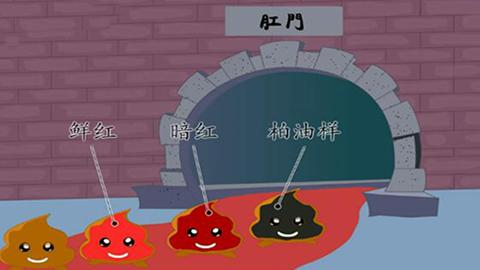 大理肛泰肛肠医院：哪些肛肠病会引起便血？