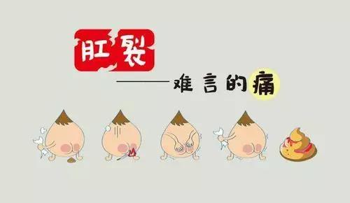 大理肛泰肛肠医院：怎样促进肛裂愈合