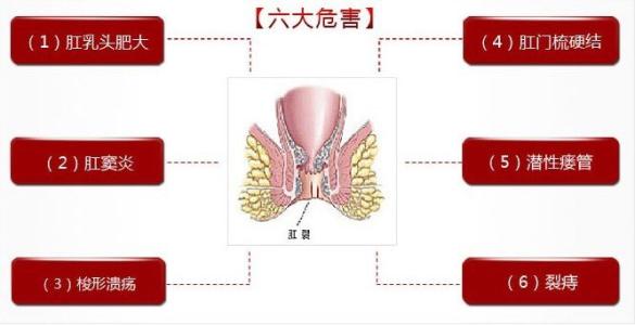 大理肛泰肛肠医院：肛裂如何自我护理